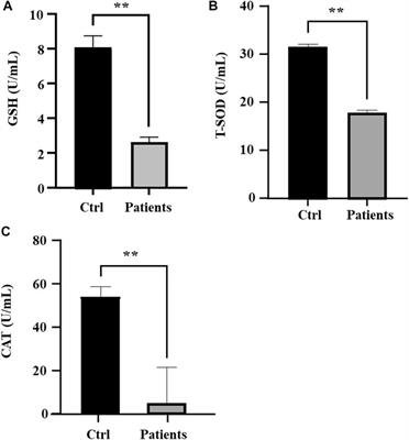 Bilateral varicocele leads to ferroptosis, pyroptosis and necroptosis of human spermatozoa and affects semen quality in infertile men